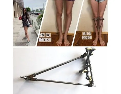 Veklich Device Franchise For Sale - image 2