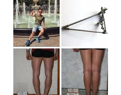 Veklich Device Franchise For Sale