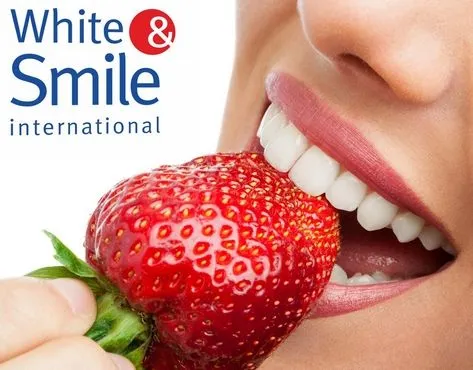 White&Smile Franchise For Sale - Cosmetic Express Teeth Whitening - image 2