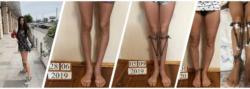 Veklich Device franchise to own